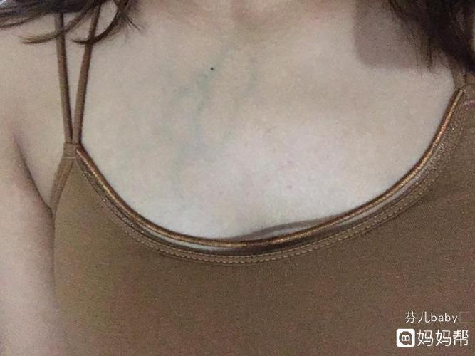 怀孕之后左边胸部的青筋就特变明显怎么回事
