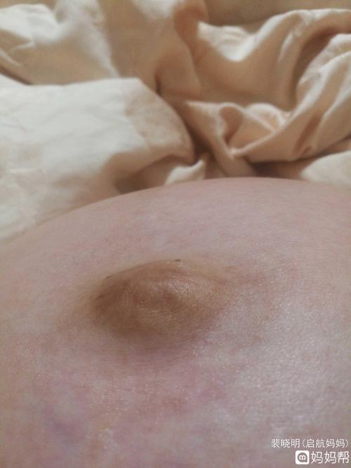 孕二十八周为什么肚脐眼这么突几乎都能