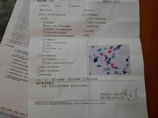为什么会感染hpv?