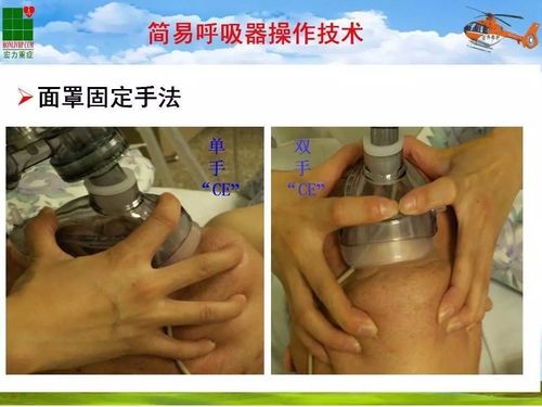 二,使用简易呼吸气囊的适应症