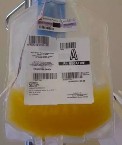 世界首用ips细胞大规模生产血小板