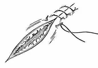 外科手术缝合之图文全集