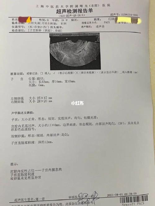 [异常出血]之第二段换医院检查_阴超_上海中医药大学附属曙光医院(东