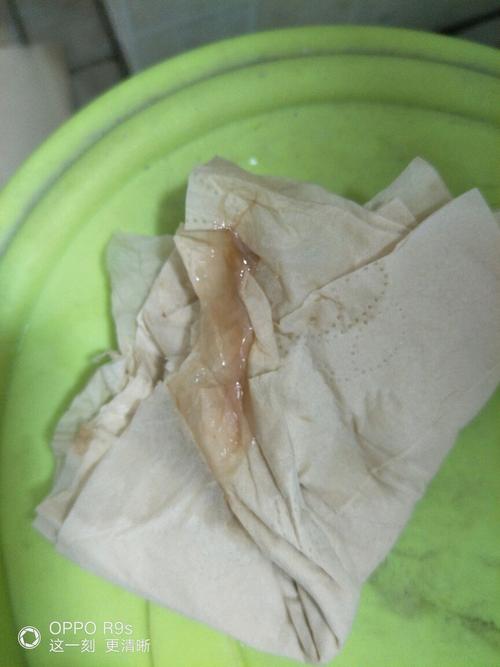 爬完楼梯,内裤上就湿了一大块,也不知是啥,然后就留出褐色分泌物,请问