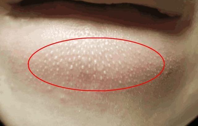 许多人不知道螨虫怕什么,试试这招,家里再也见不到一只螨虫!