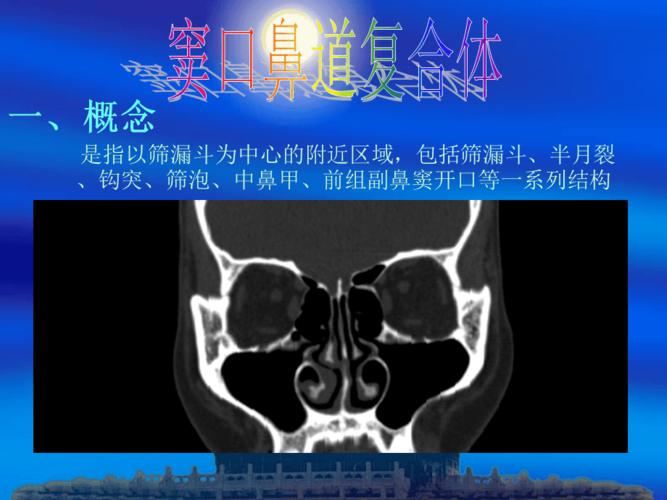 窦口-鼻道复合体