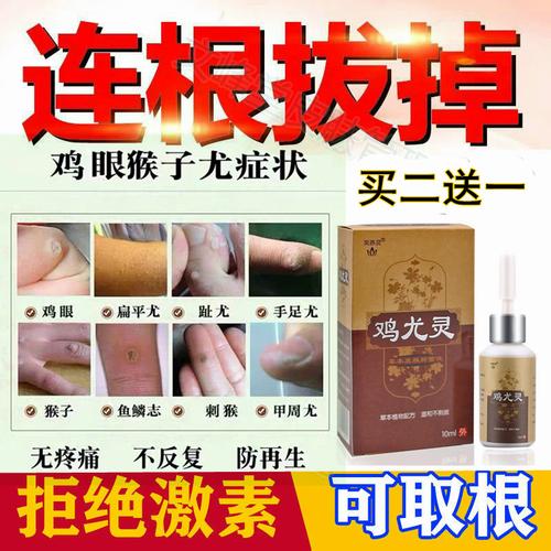 鸡眼神器拓趾跖疣膏手足部扁平疣日本病毒去疣灵瘊子寻常疣刺鸡眼