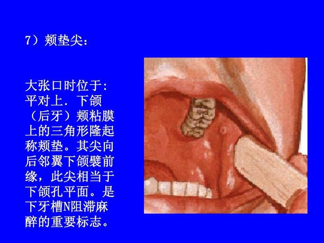 平对上.下颌 后牙) (后牙)颊粘膜 上的三角形隆起 称颊垫. 称颊垫.