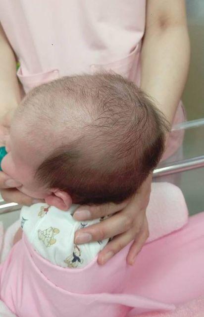 新生宝宝刚出生的时候身体会覆盖着胎毛,在准备出生前左右会开始掉毛