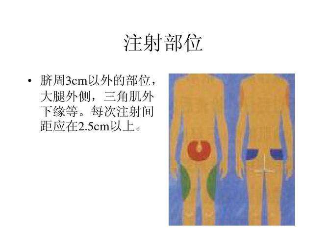 注射部位   脐周3cm以外的部位, 大腿外侧,三角肌外 下缘等.