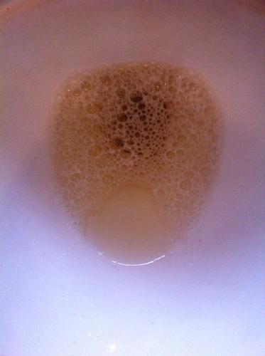 每天早上起来的第一泡尿,这么多泡泡,好像要很久才能全散开.