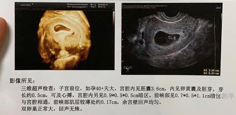 四维无意间看到三条线!翻盘!
