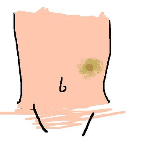 腹部包块,这是什么来的?