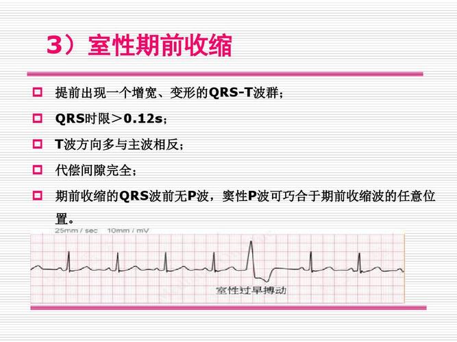 常见异常心电图ppt