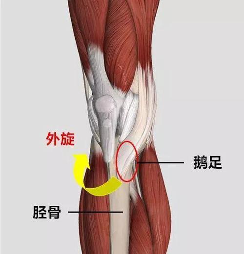 膝关节疼痛当心"鹅足"在作怪!