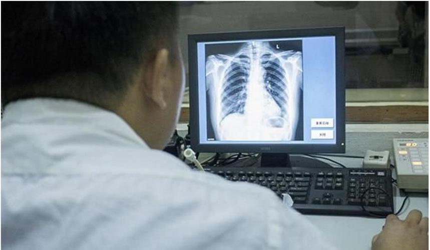 女性不愿意做胸透,是医生可能看到什么吗?一次性告诉你真实内幕