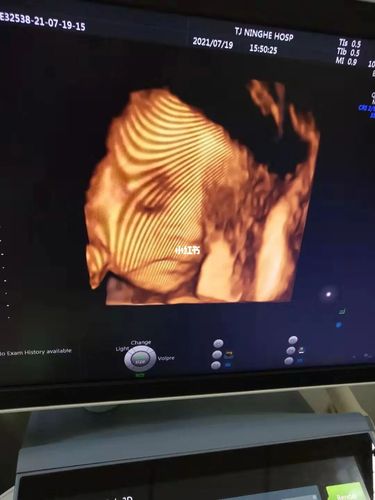 28周 ,已慢慢进入了角色～_四维彩超_母婴_孕产经验