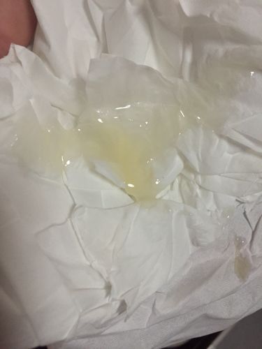 这精液颜色正常吗?