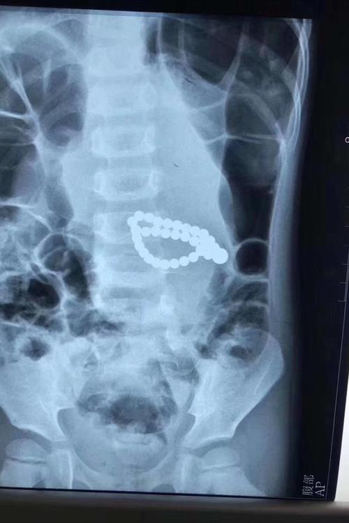 央视曝光"能量石",核辐射严重超标,佩戴1天等于胸透