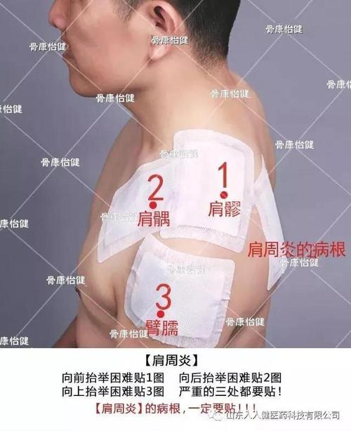 传统黑膏药/骨康怡健冷敷贴使用方法 真人贴敷图