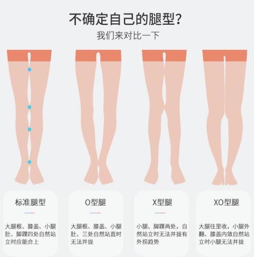 儿童膝内翻膝外翻在什么情况下需要进行治疗