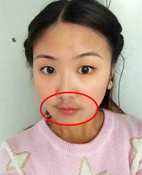 唇毛 无非是这3个原因