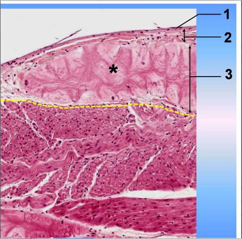 心壁光镜像,示心内膜和心肌膜(黄色虚线上下),请判断图中1所示的是