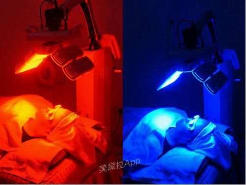 蓝光治疗仪采用进口光源,以新型高能量密