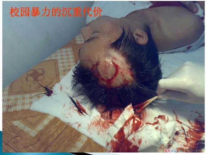 远离校园暴力-主题班会课件ppt