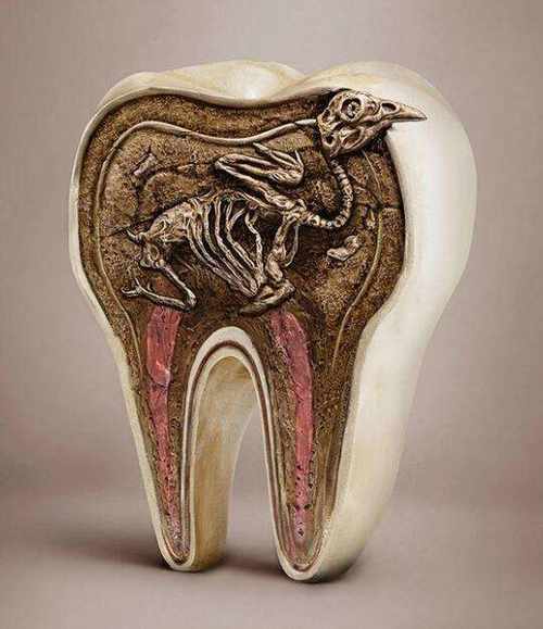 牙虫的故事和牙虫的图片