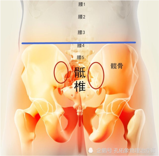 骨盆中的骶髂关节(下图中红色圈的位置)发生错位紊乱是比较多见的