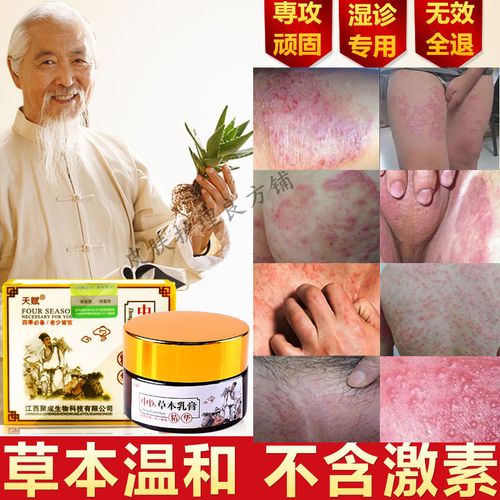 皮肤专用湿疹霜治疗皮炎外用药膏止痒去根阴囊肛门肛周瘙痒病潮湿