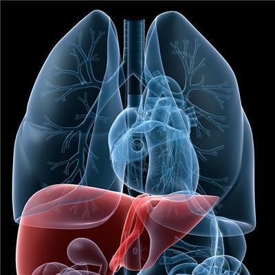 且较慢性支气管炎所致扩张为严重