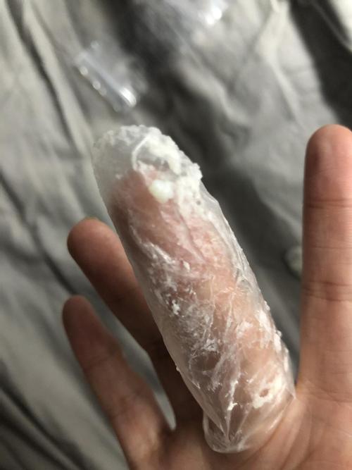 是豆腐渣状白带吗 有图慎入