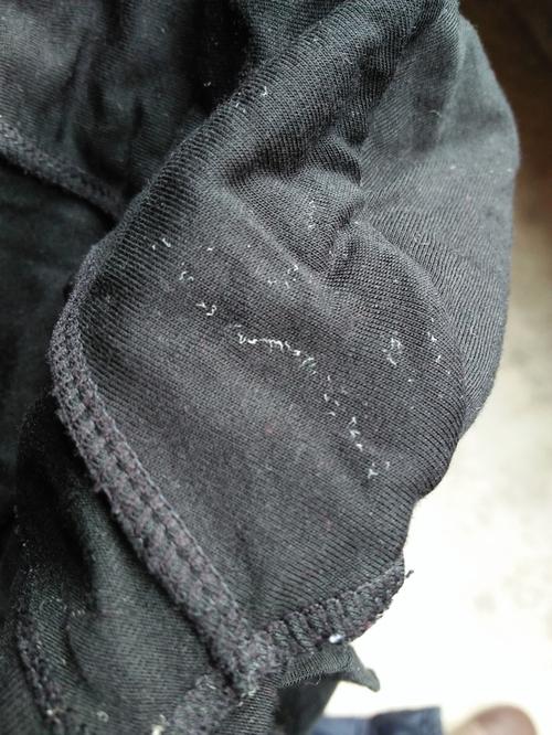 内裤上是这样子还能穿嘛,这是什么东西?白白的?