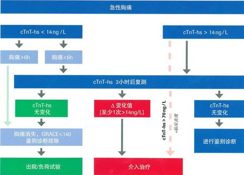 罗氏elecsys高敏肌钙蛋白t检测