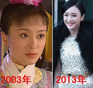 秦岚个人资料情史曝光 整容前后照片对比引争议