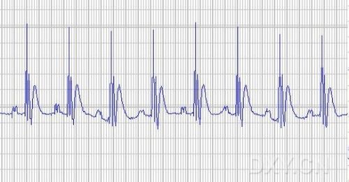 实验动物心电图之讨论(图)
