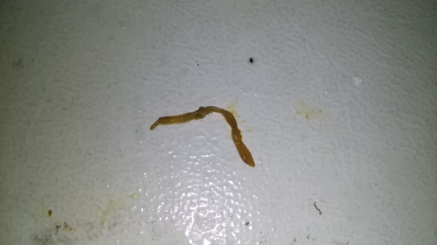 便便出现这个东西怎么回事啊,条状的,略透明