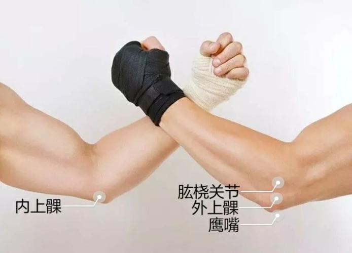 肘劳第四趴→尺骨鹰嘴滑囊炎