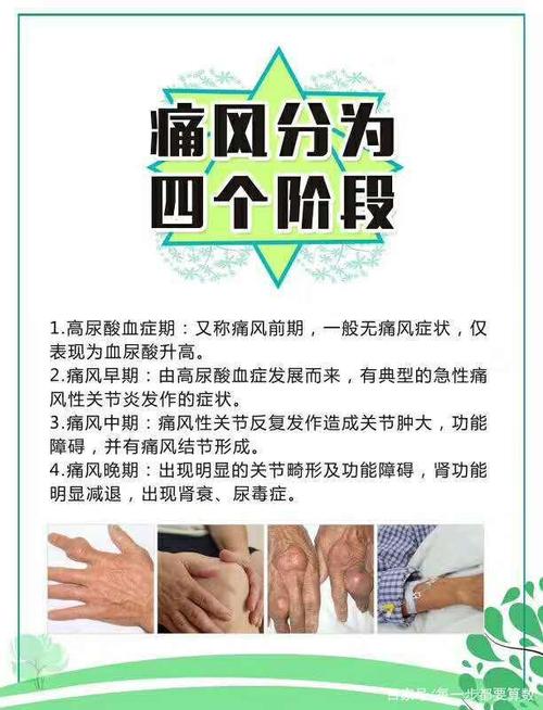 痛风阶段,每向前迈进一个阶段,就如同从悬崖向下摔下