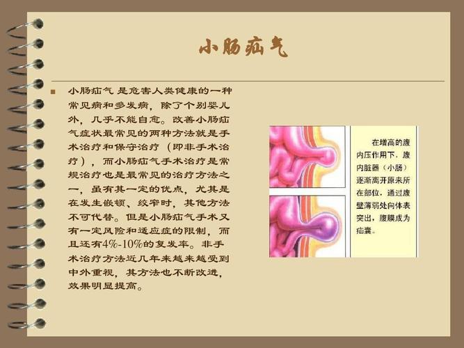 小肠疝气是什么ppt