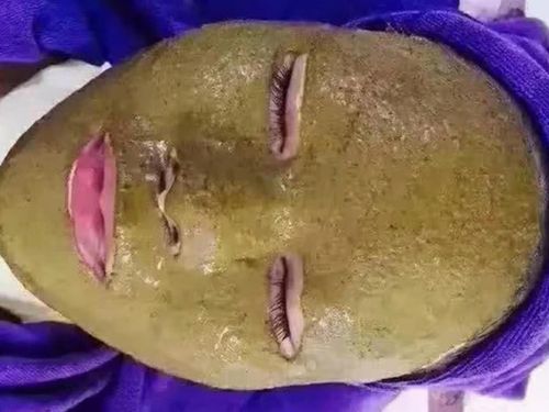 中药面膜敷完面部以后不要立即上妆