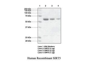 sirtuin 5 (sirt5) protein (gst tag,gst tag,gst tag)