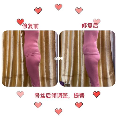 骨盆修复(骨盆后倾)_骨盆_母婴_妈妈经验