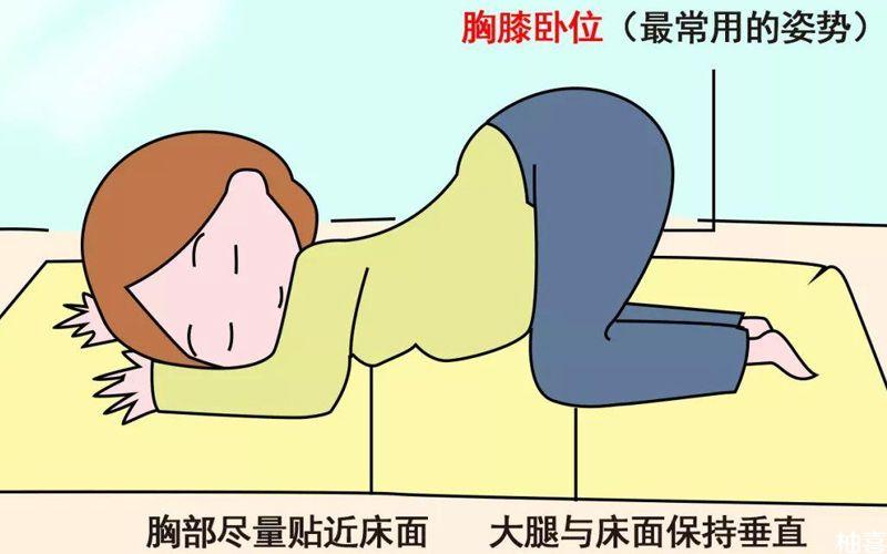 纠正臀位可以膝胸卧位