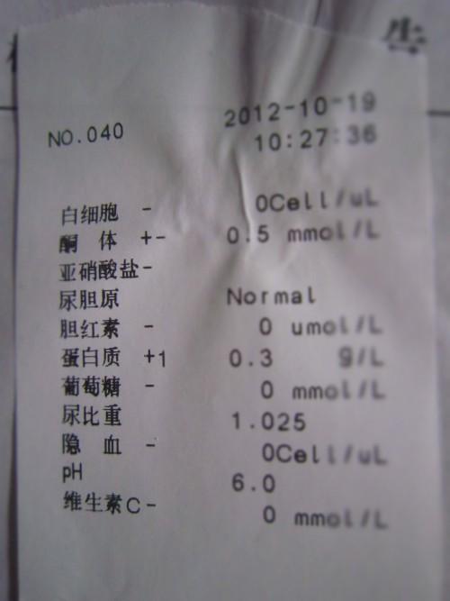 尿蛋白偏高的介绍