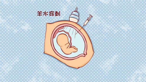羊水穿刺报销流程 羊水穿刺属于医保范畴吗
