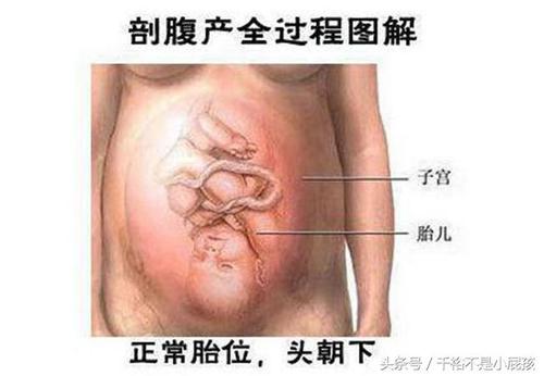 生孩子分为 顺产和 剖腹产,顺产需要等宫口开到10指,再分娩,分娩前