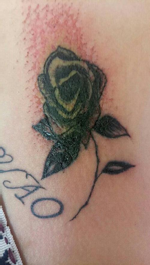 纹身四天皮肤受损严重而且伴有刺痛肿胀感怎么办